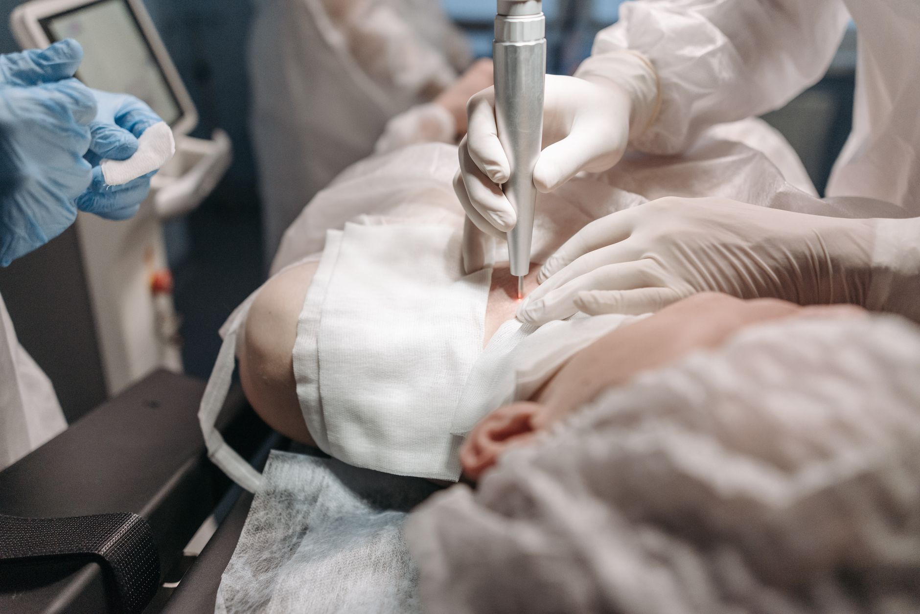 A Guide to Fractional CO2 Laser