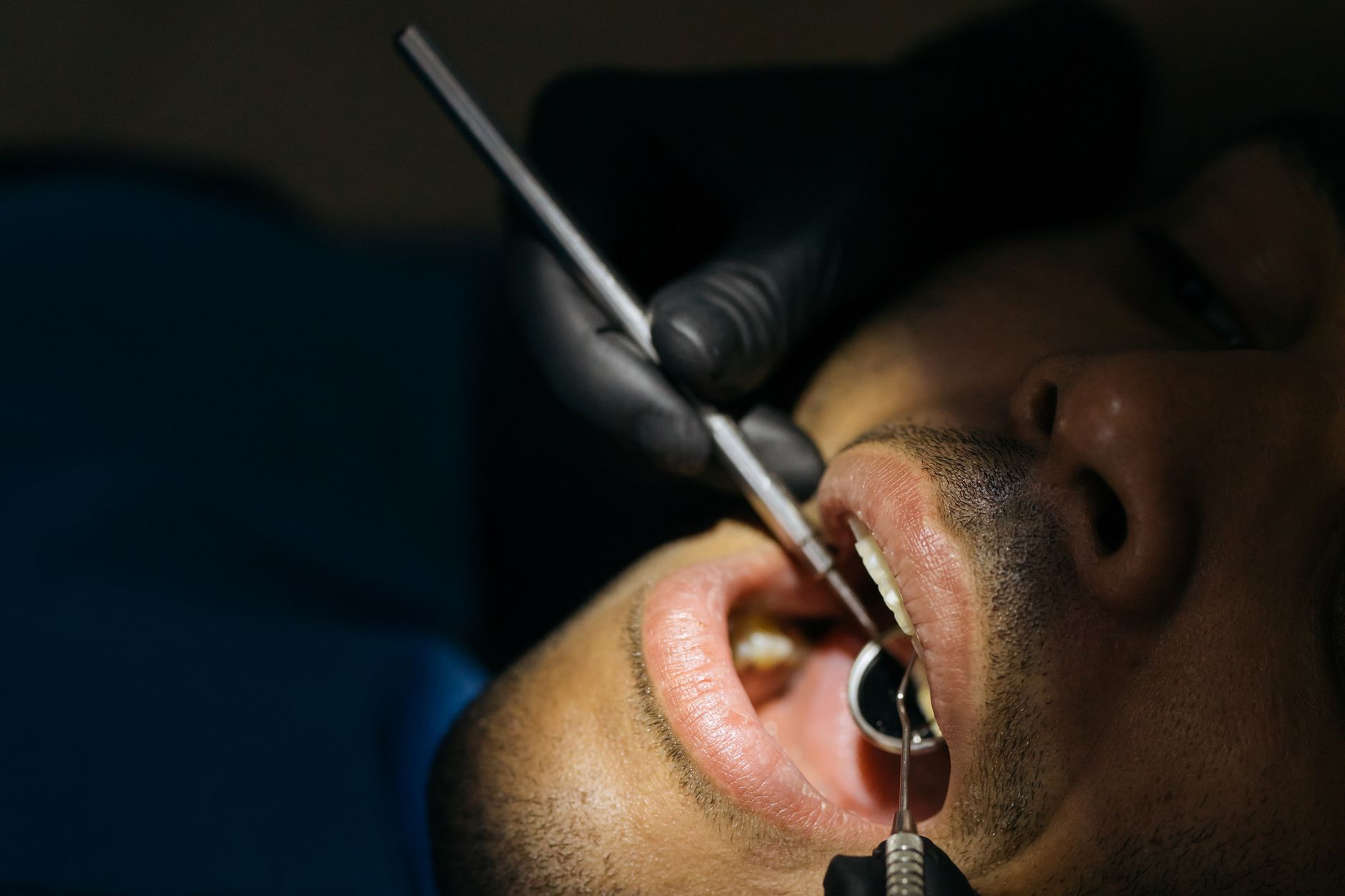 What to Expect from a Dental Filling Appointment in Memorial City, West Houston