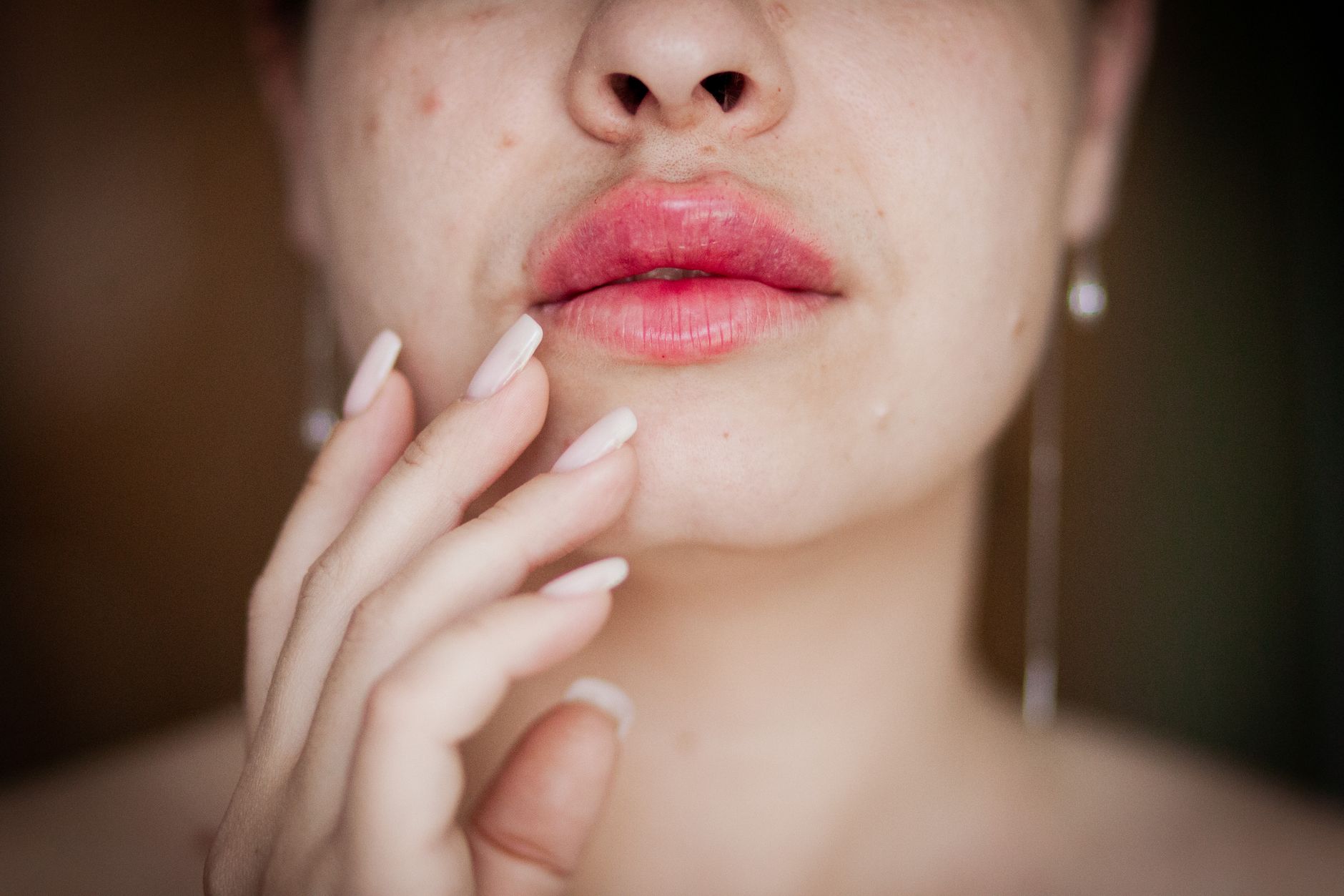 Debunking Myths About Fillers