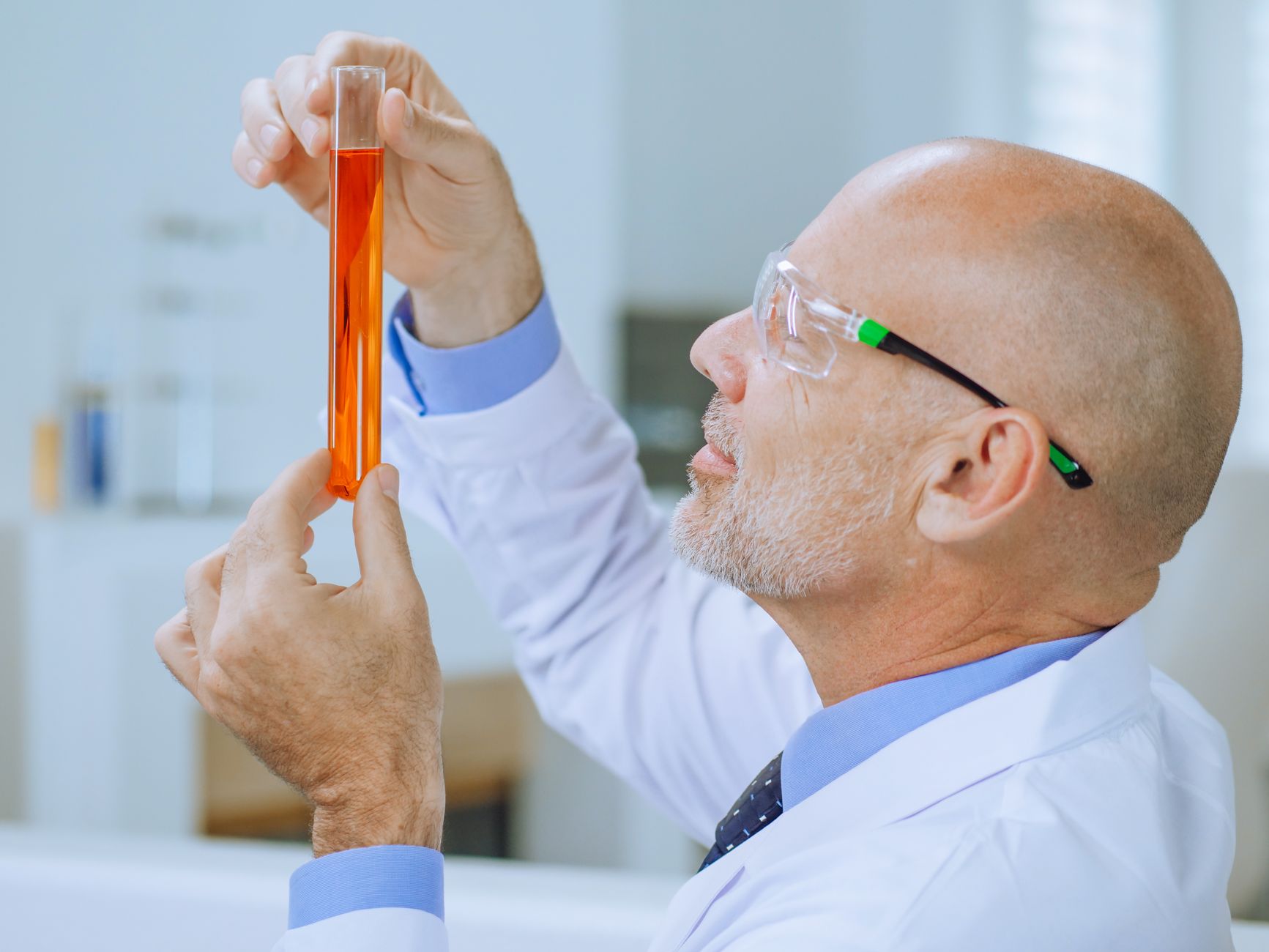 Semen Analysis Efficacy in Revealing The Cause of Male Infertility