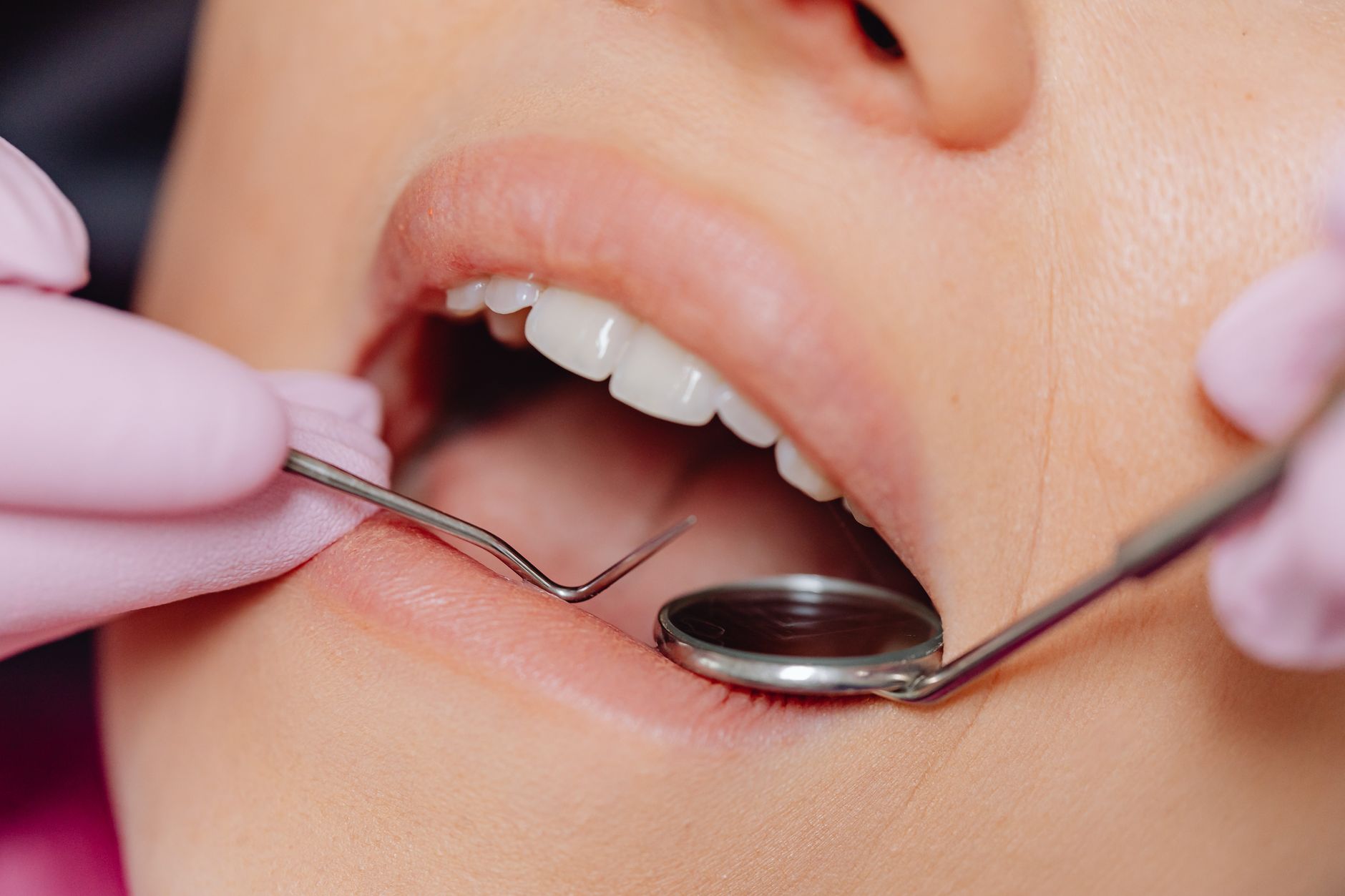 6 Mild to Severe Teeth and Mouth Diseases