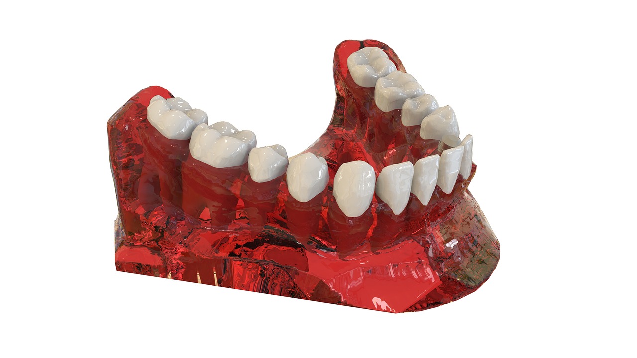 Deciding Between Veneers And Implants: A Cosmetic Dentistry Guide
