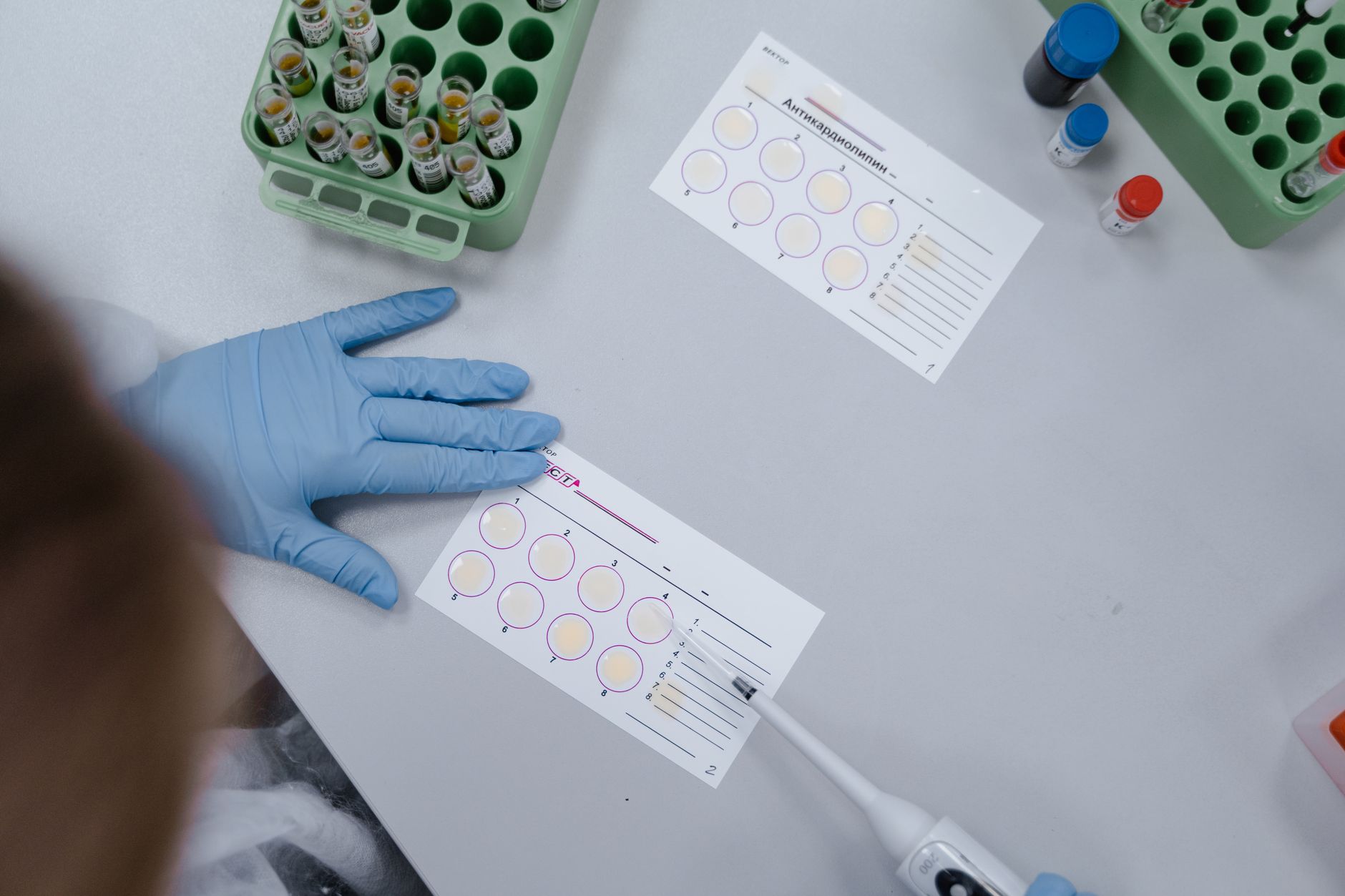 FDA selects Lilly, Regeneron for fast-track facility reviews