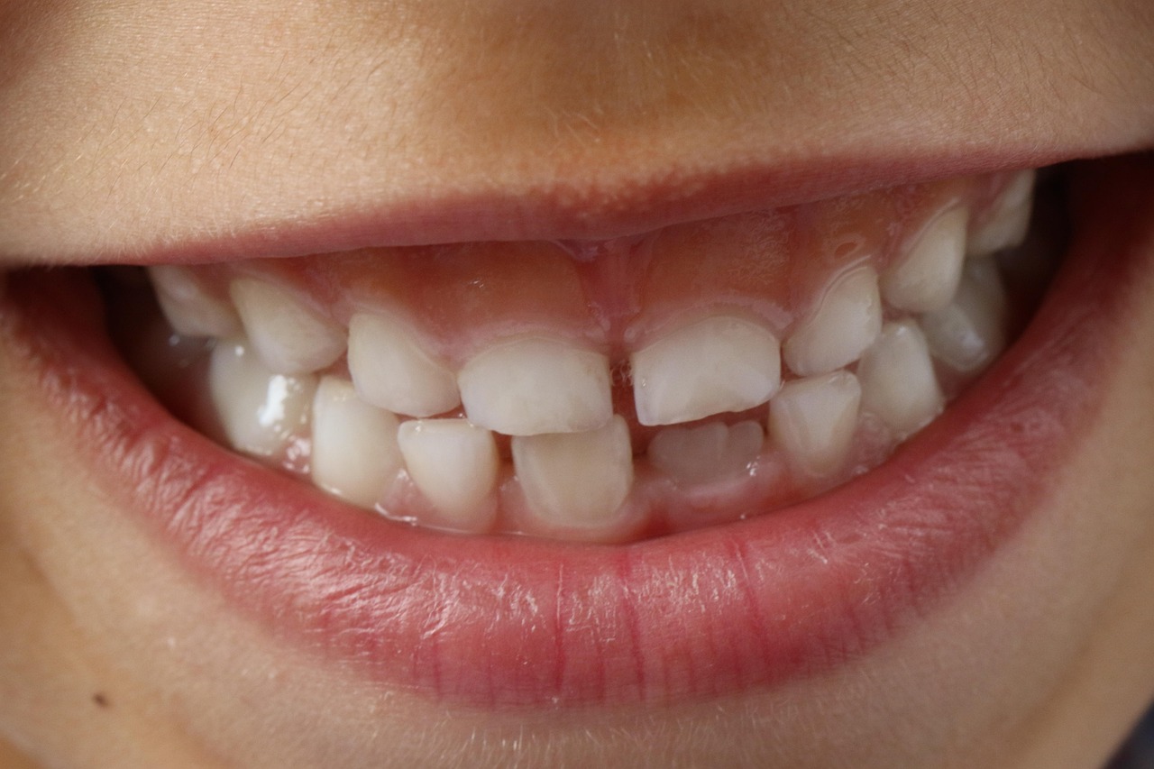 Easy Care for Teeth and Gums at Home