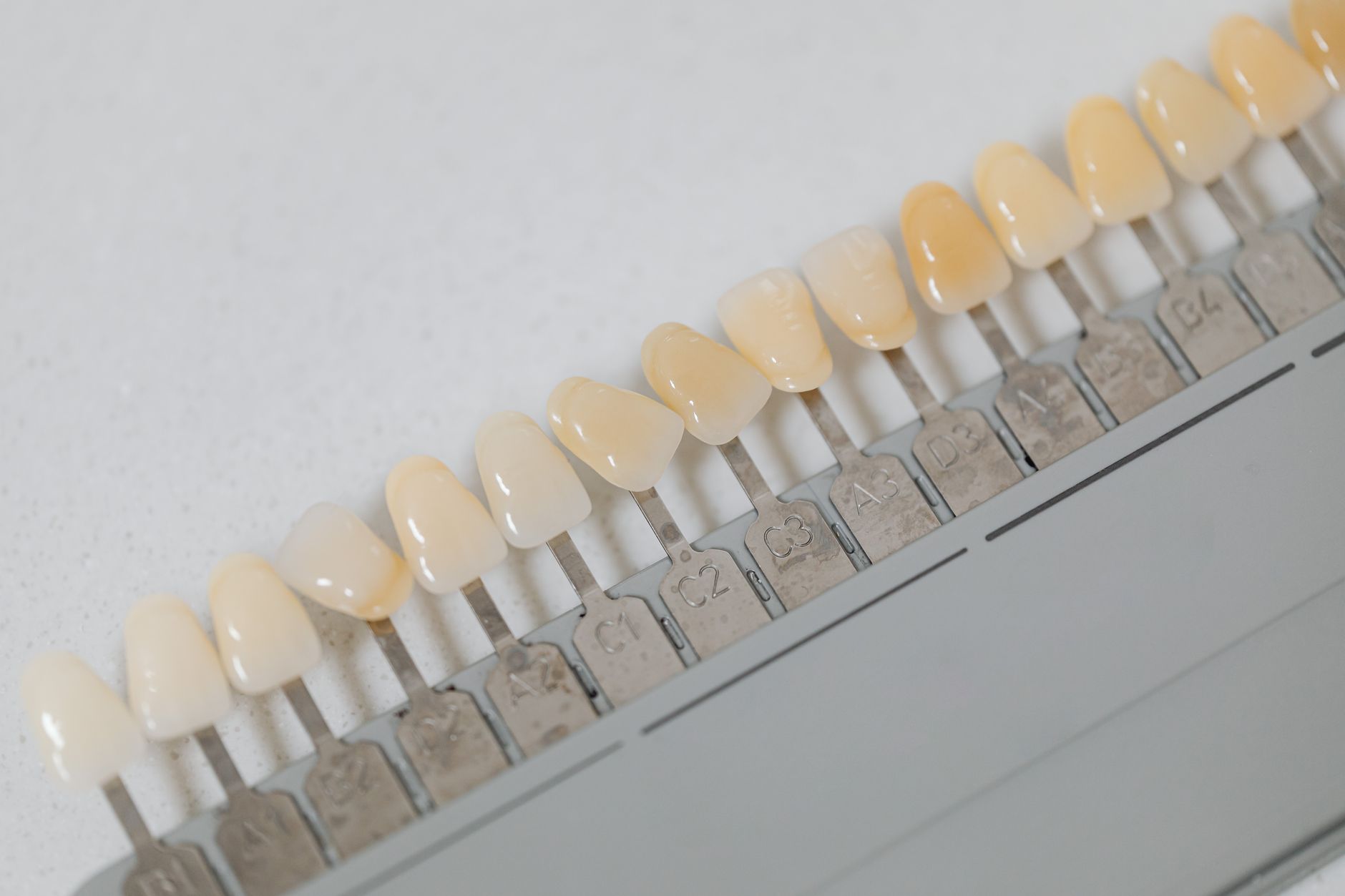 Porcelain Veneers: An Insight Into The Popular Cosmetic Dentistry Procedure