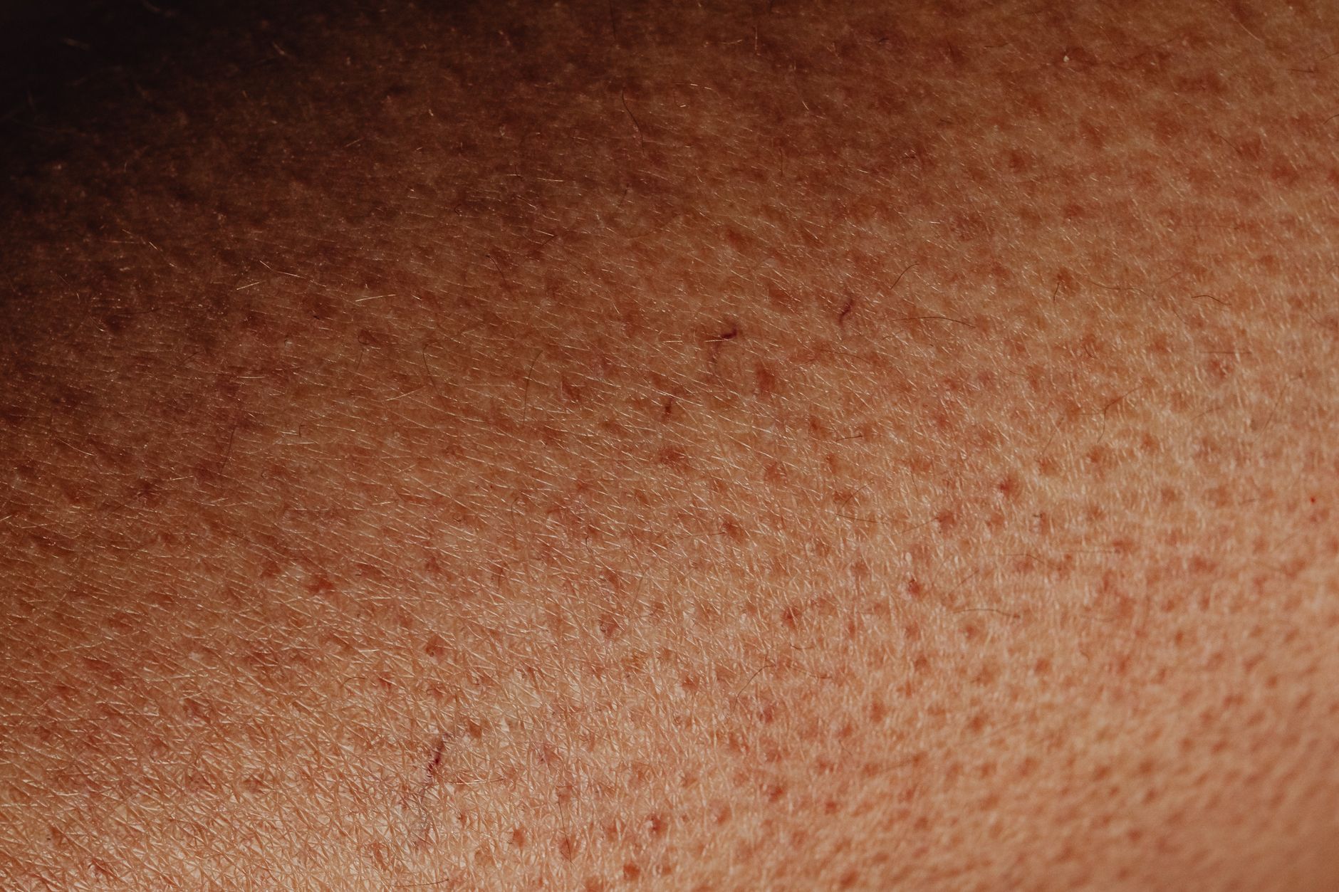 Dermatology Near Me: The Hidden Dangers of Choosing Local Clinics