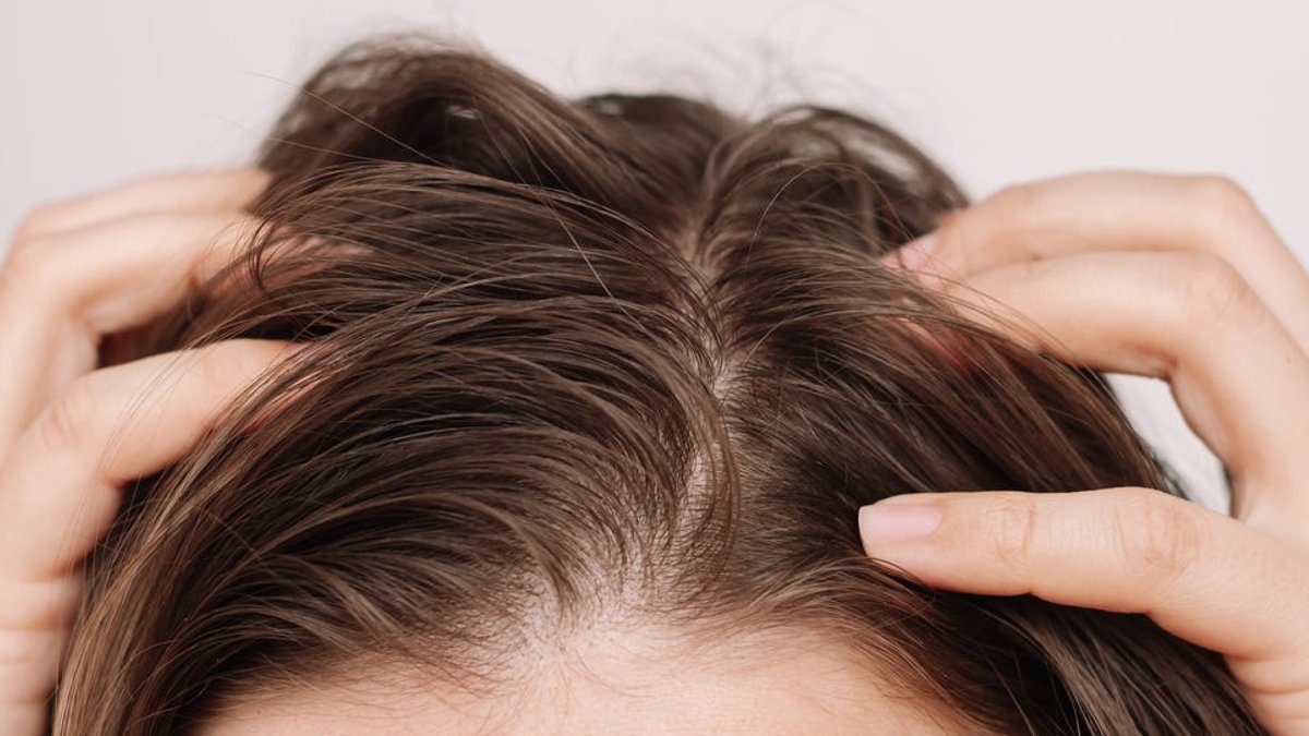 Common Scalp Conditions Lead to Bumps and Itch - scalp conditions