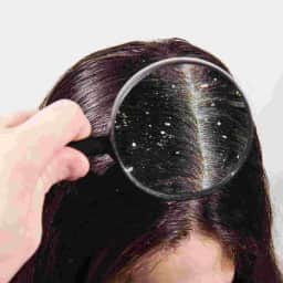 Hair spa & oil treatment - Anti-dandruff treatment