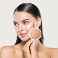 Facials & cleanups - Oil control facials