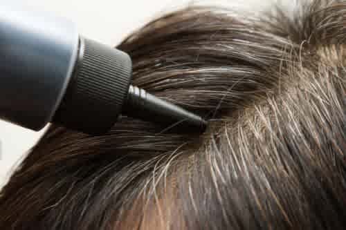 grey hair treatment