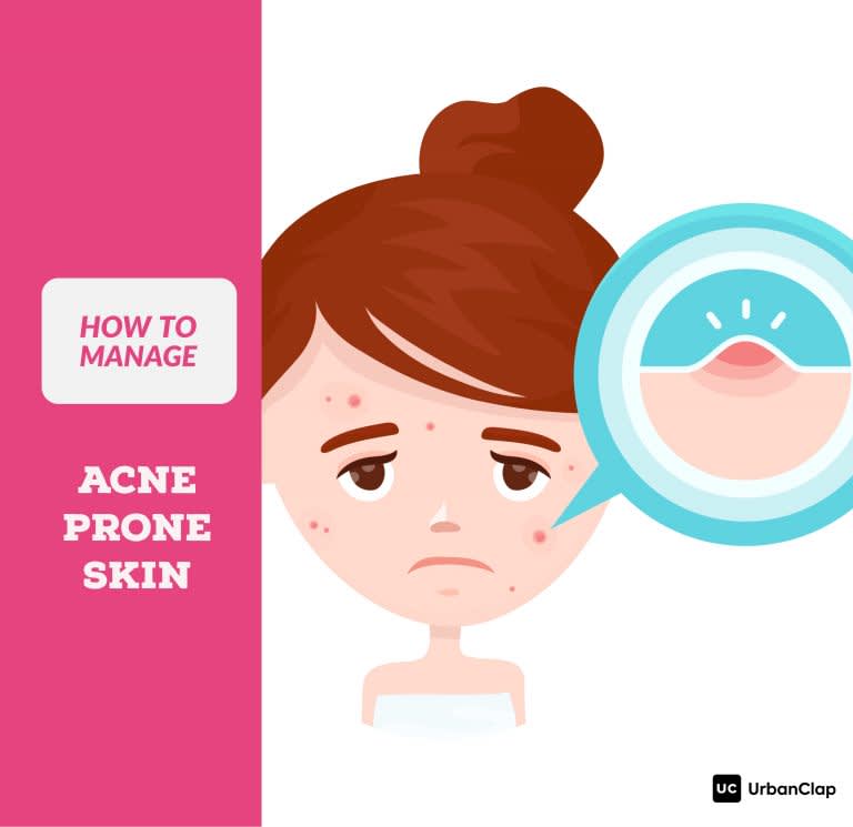 How To Manage Acne Prone Skin