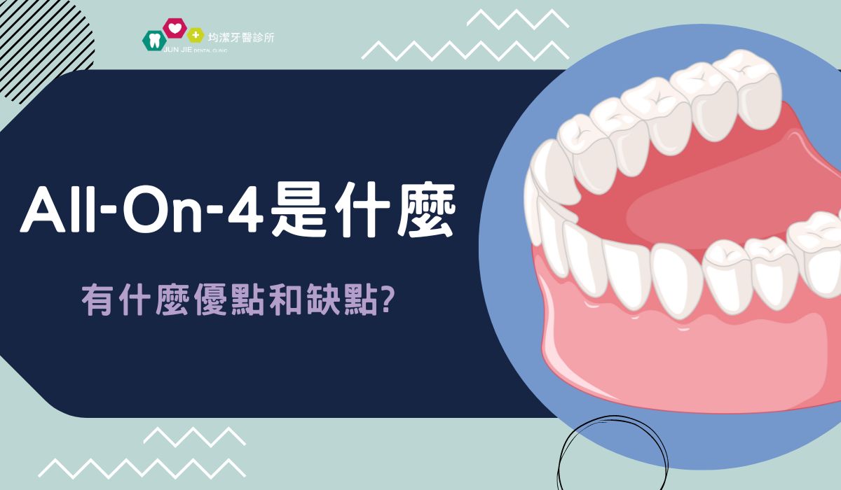 一篇搞懂 All-on-4、優缺點、費用