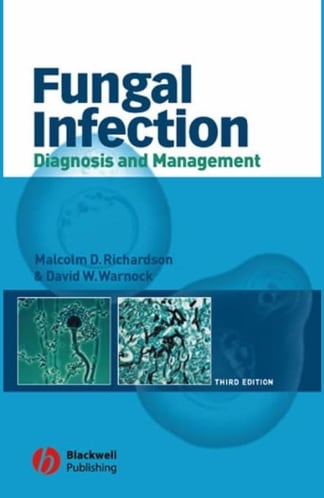 Buy Fungal Infection: Diagnosis And Management Second Hand Books Online India from Used Book Store