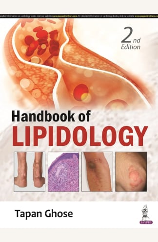 Buy Handbook Of Lipidology Used Books Online from Used Book Store