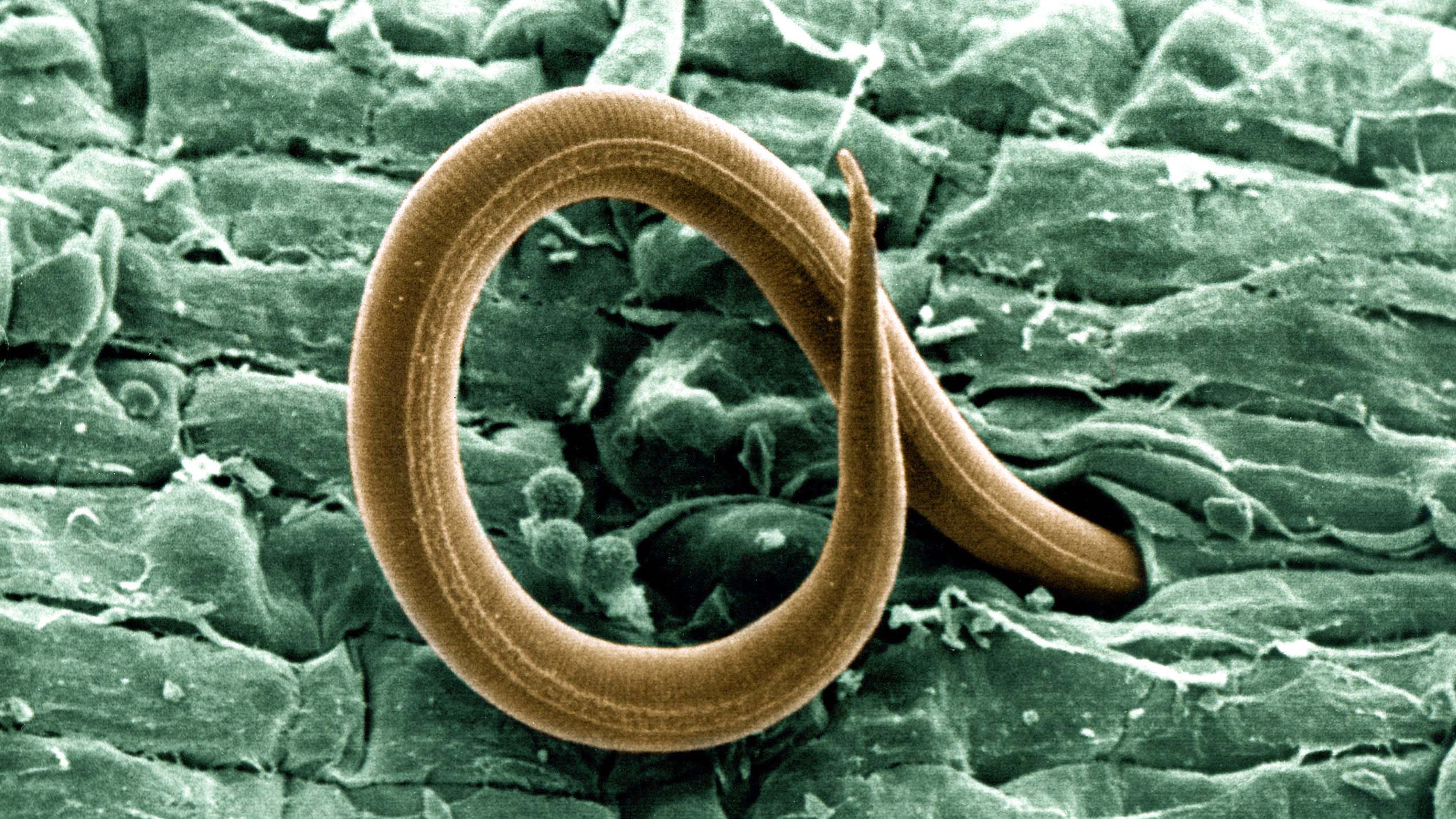 Photograph of a nematode (under microscope; ×100) indicating the three