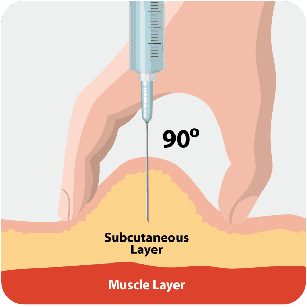 Where to Inject Insulin & How to Keep Insulin Injection Sites Healthy ...