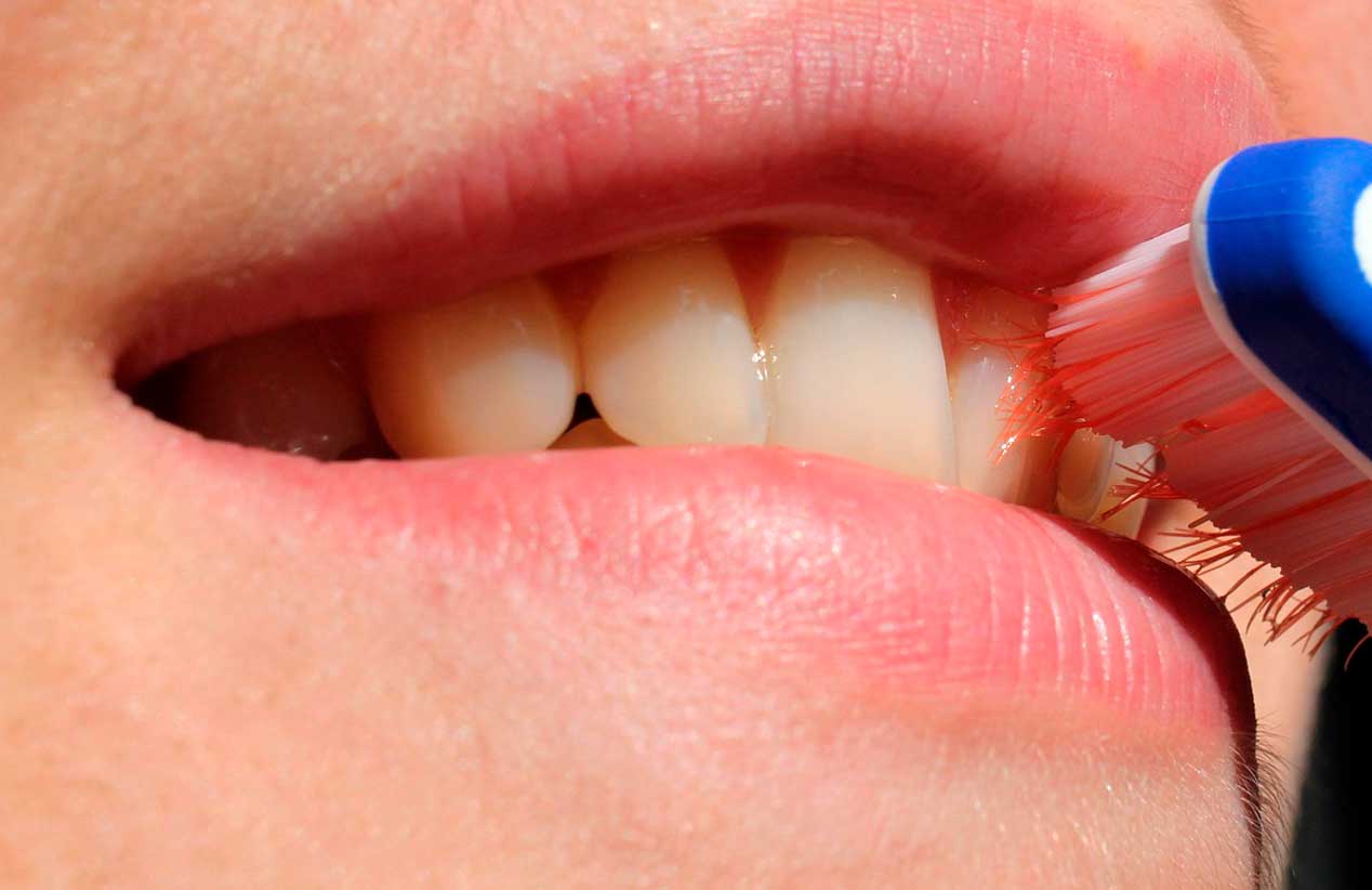 Blanqueamiento dental, el proyecto que ganó la I Feria Cientifica para colegios