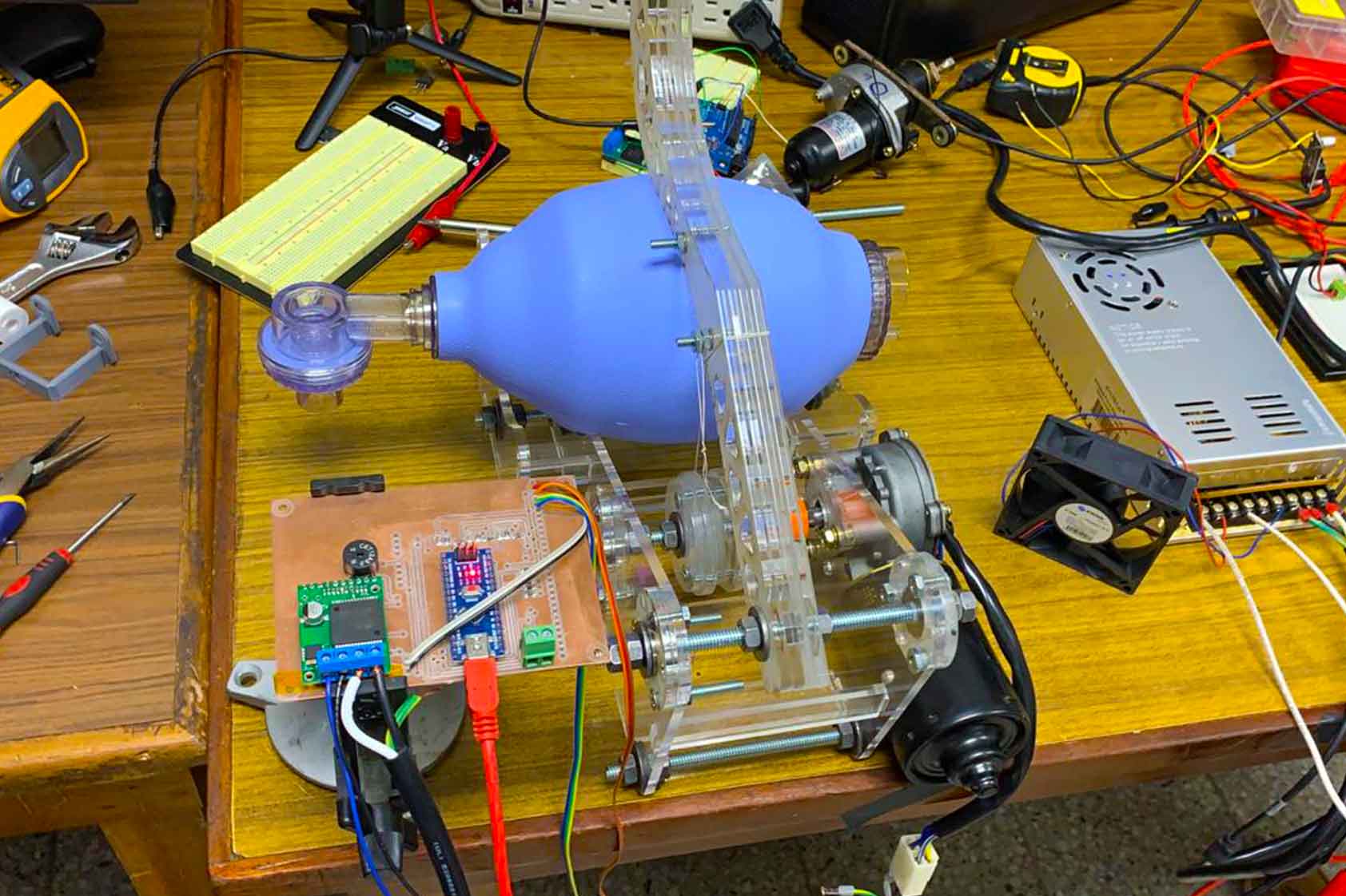 En UVG desarrollamos una máquina de ventilación automática