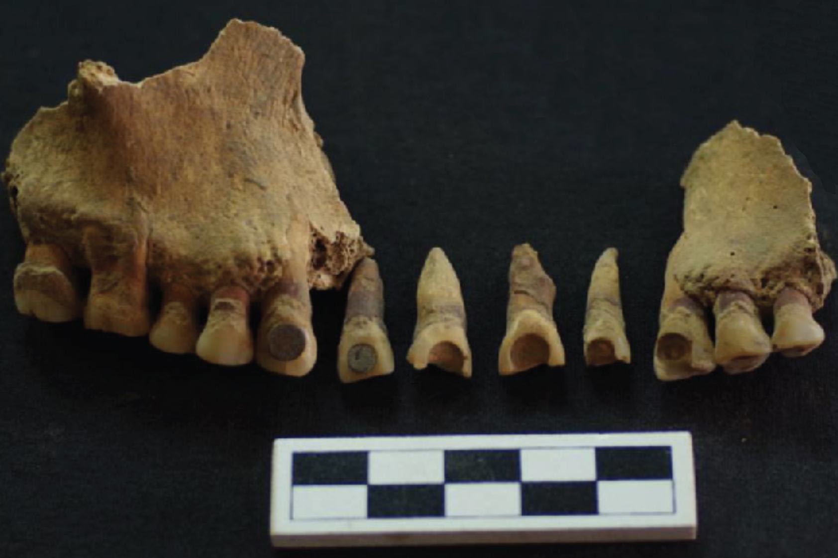 El enigma de las incrustaciones dentales mayas: cuando la Química  ayuda a la Arqueología