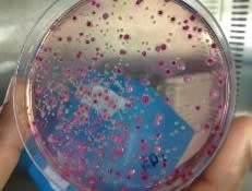 Estudio sobre resistencia antimicrobiana CES UVG