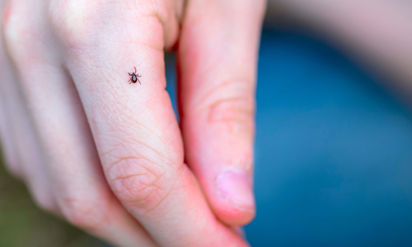 Mite on child's hand. Dangerous tick on the skin crawls along the arm.