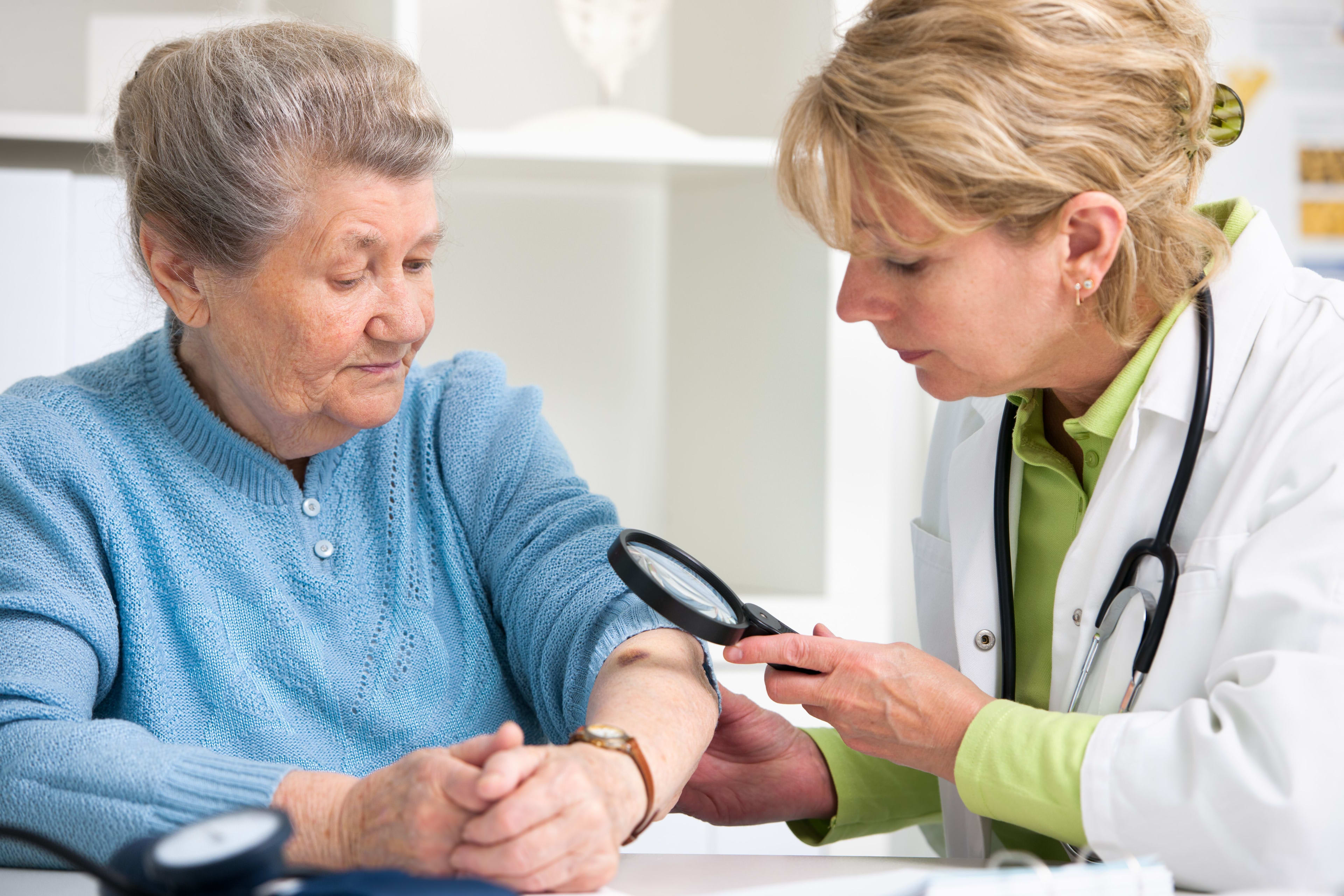 Melanoma Specialists, Symptoms & Treatment | Conditions | UW Health