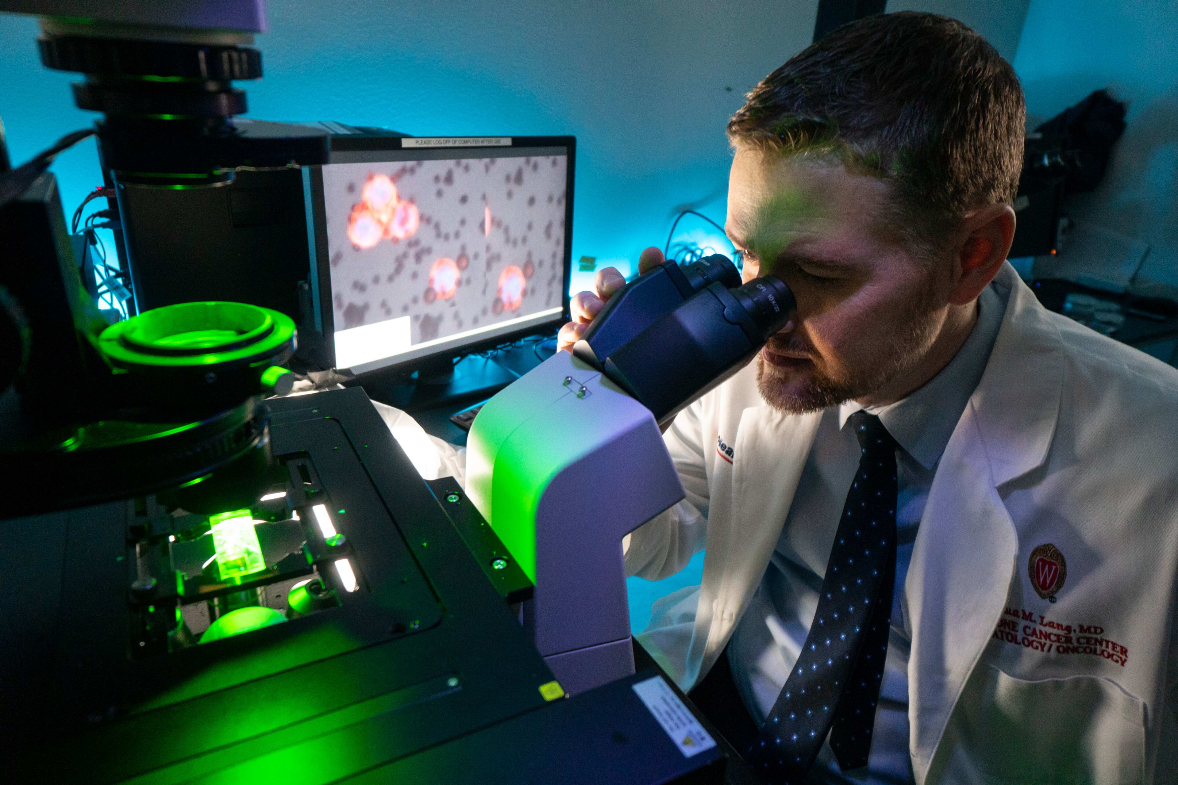 Using Blood Tests To Advance Cancer Treatments Uw Health