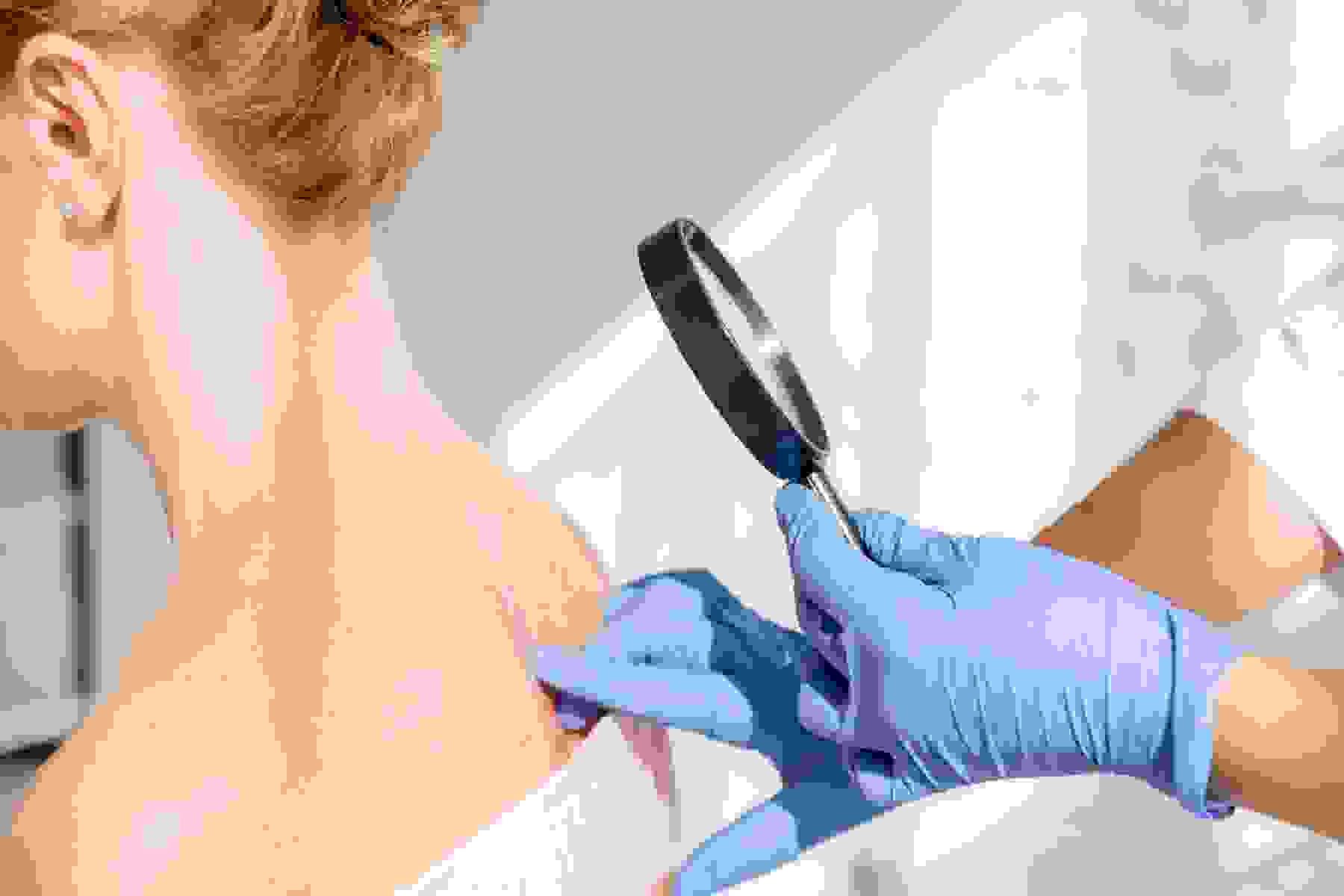 A dermatologist examining a patient's back