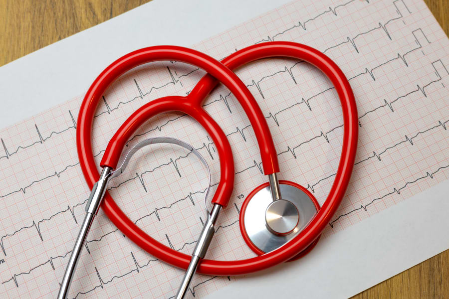 Heart disease is among the 21 causes of death tracked in our study.