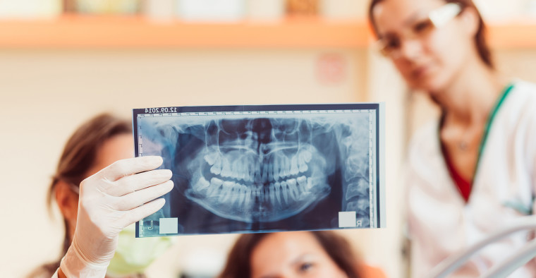Two dentists and a patient look at an x-ray image of a woman's mouth.