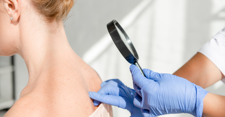 A dermatologist examining a patient's back