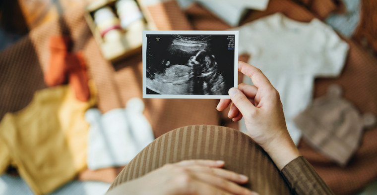 A pregnant woman caresses her stomach while looking at an ultrasound.