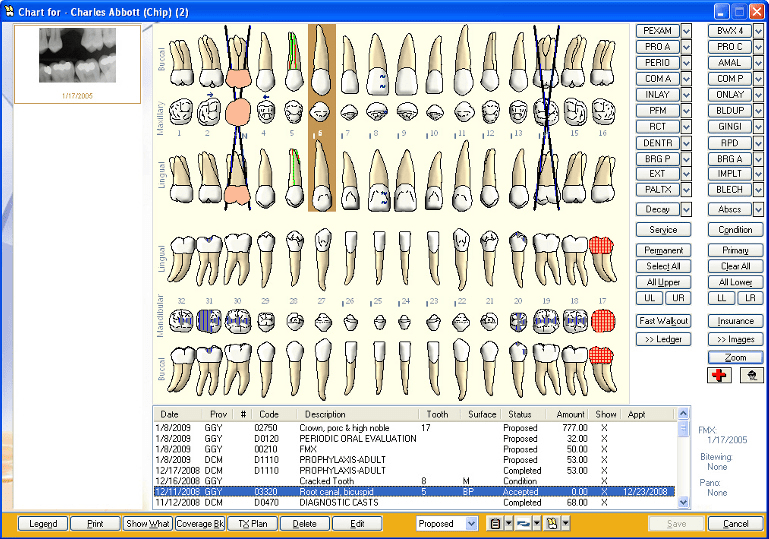Eaglesoft Chart