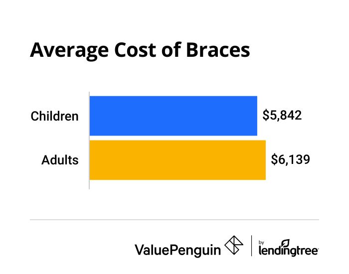 average cost of braces