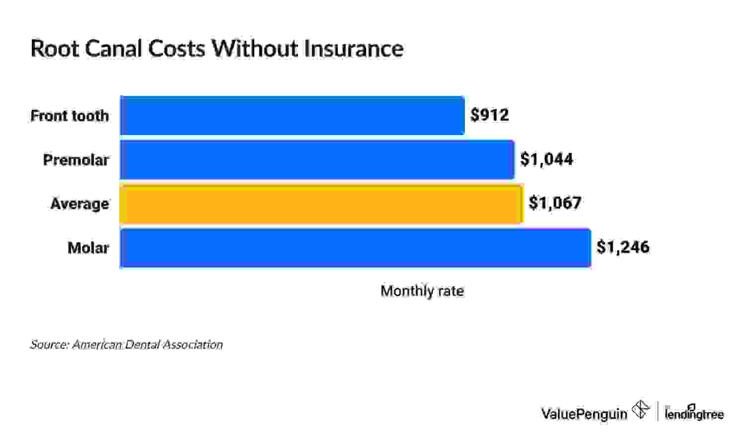 Graph showing the cost of a root canal without insurance