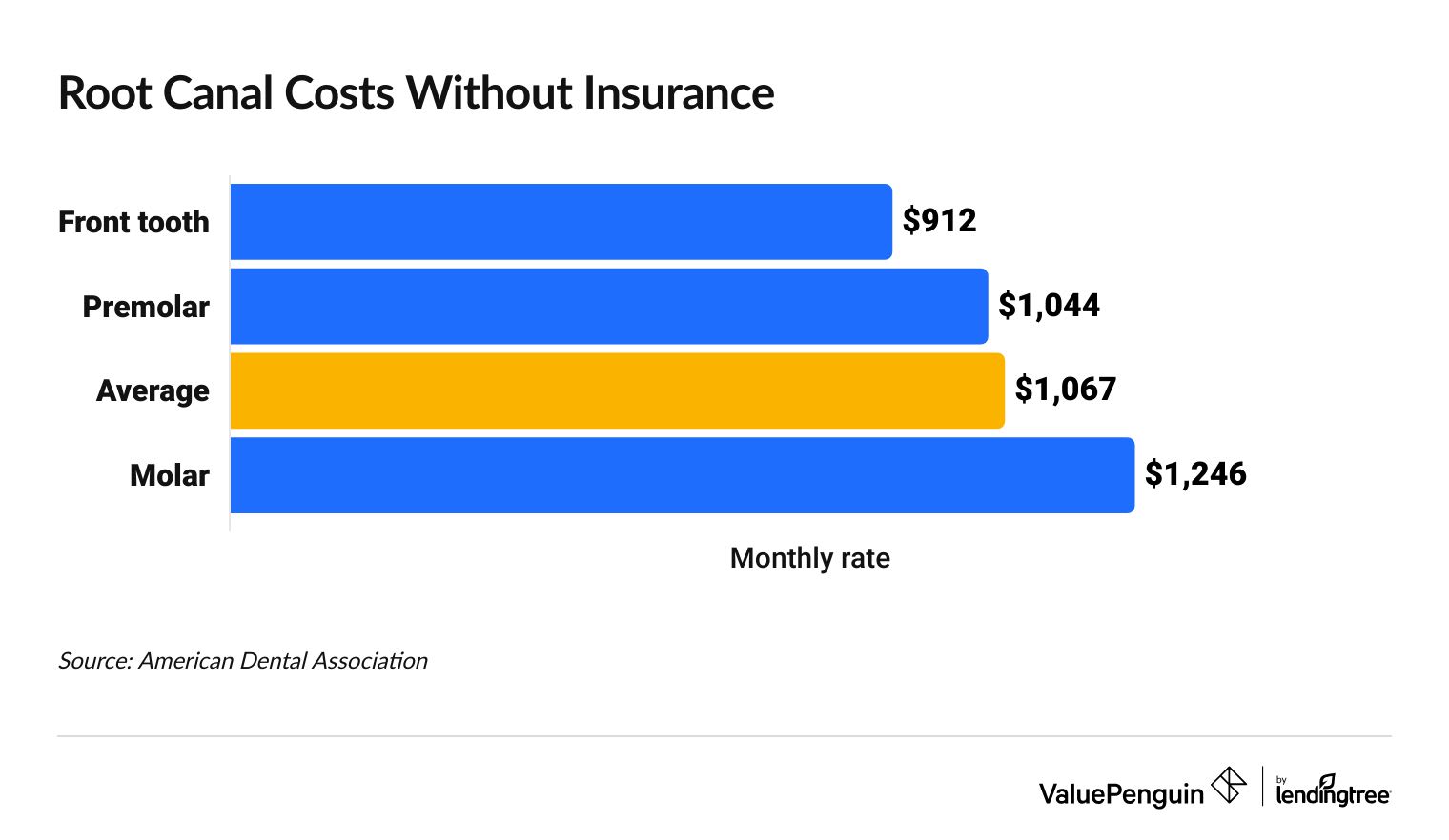 Graph showing the cost of a root canal without insurance