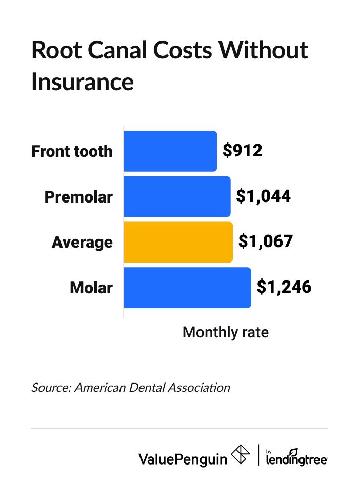 Graph showing the cost of a root canal without insurance