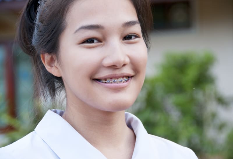 Average Cost of Braces in Singapore 2021 | ValueChampion ...