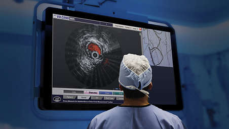 Pioneer Plus IVUS guided re-entry catheter