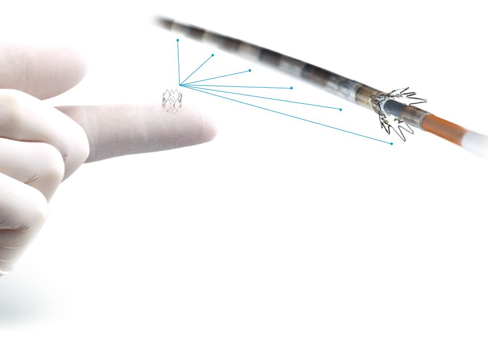 Tack Endovascular System