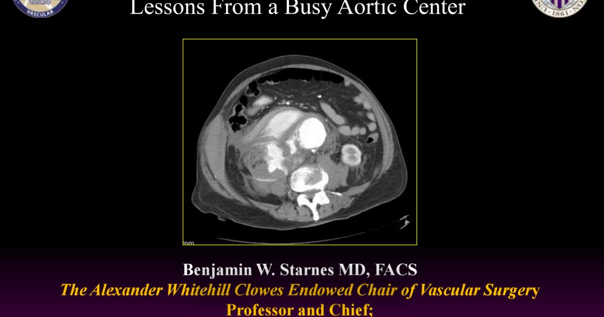 Ruptured Aneurysm Protocol: Lessons From a Busy Aortic Center – Vascupedia