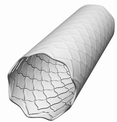 BeGraft aortic Rendering