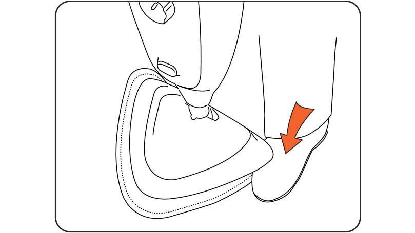 Remove pad