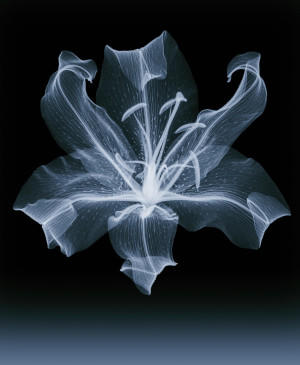 Xylem,   Family: Liliaceae   Genus: Lilium