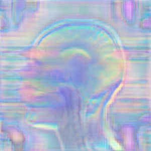 Nitrous Oxide 2