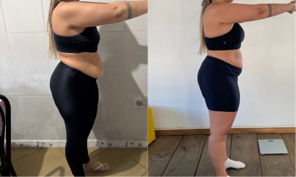 Antes e depois de Francielly — transformação com o Dieta Sem Stress