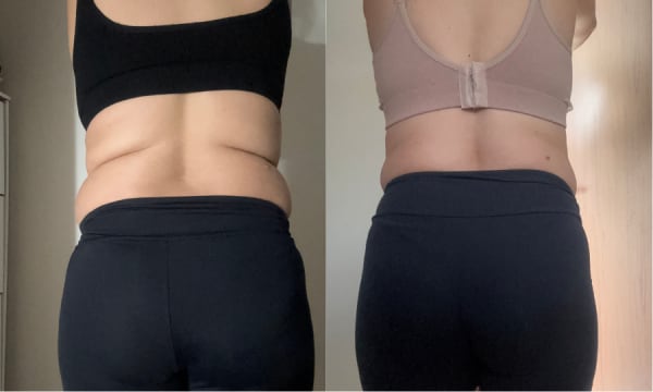 Antes e depois de Jana — resultado real com plano alimentar personalizado