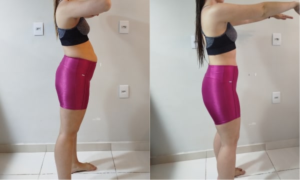 Antes e depois de Manoela — emagrecimento saudável com o Dieta Sem Stress