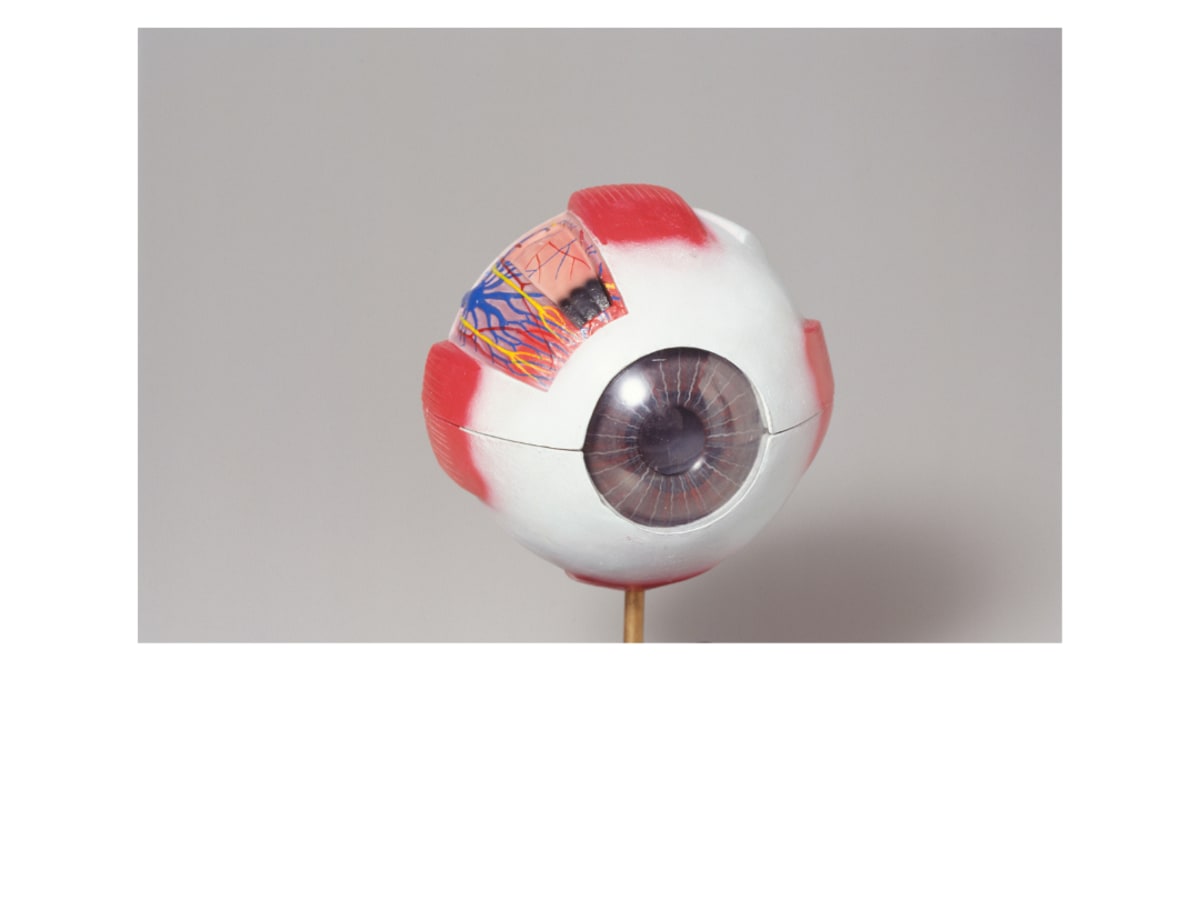 Oeil