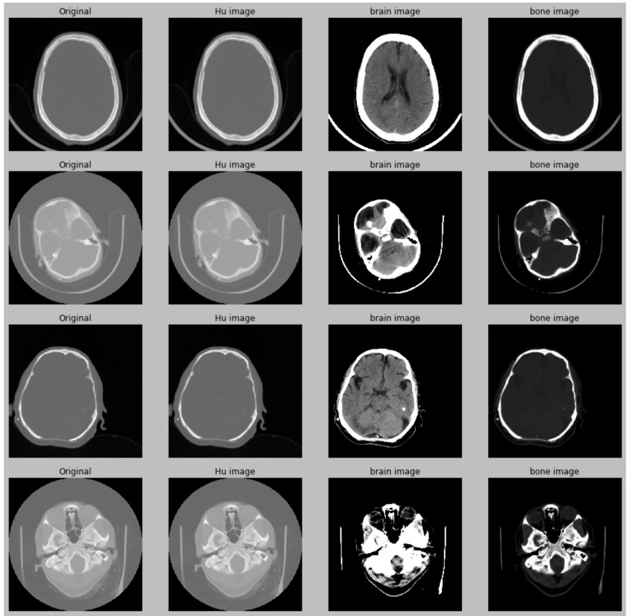 Ct examples